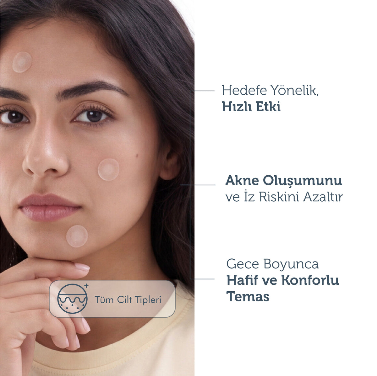 Microneedle Teknolojili Akne Patch, Sivilce Karşıtı Yama, Mikroiğneli Akne Bandı, 9 Adet
