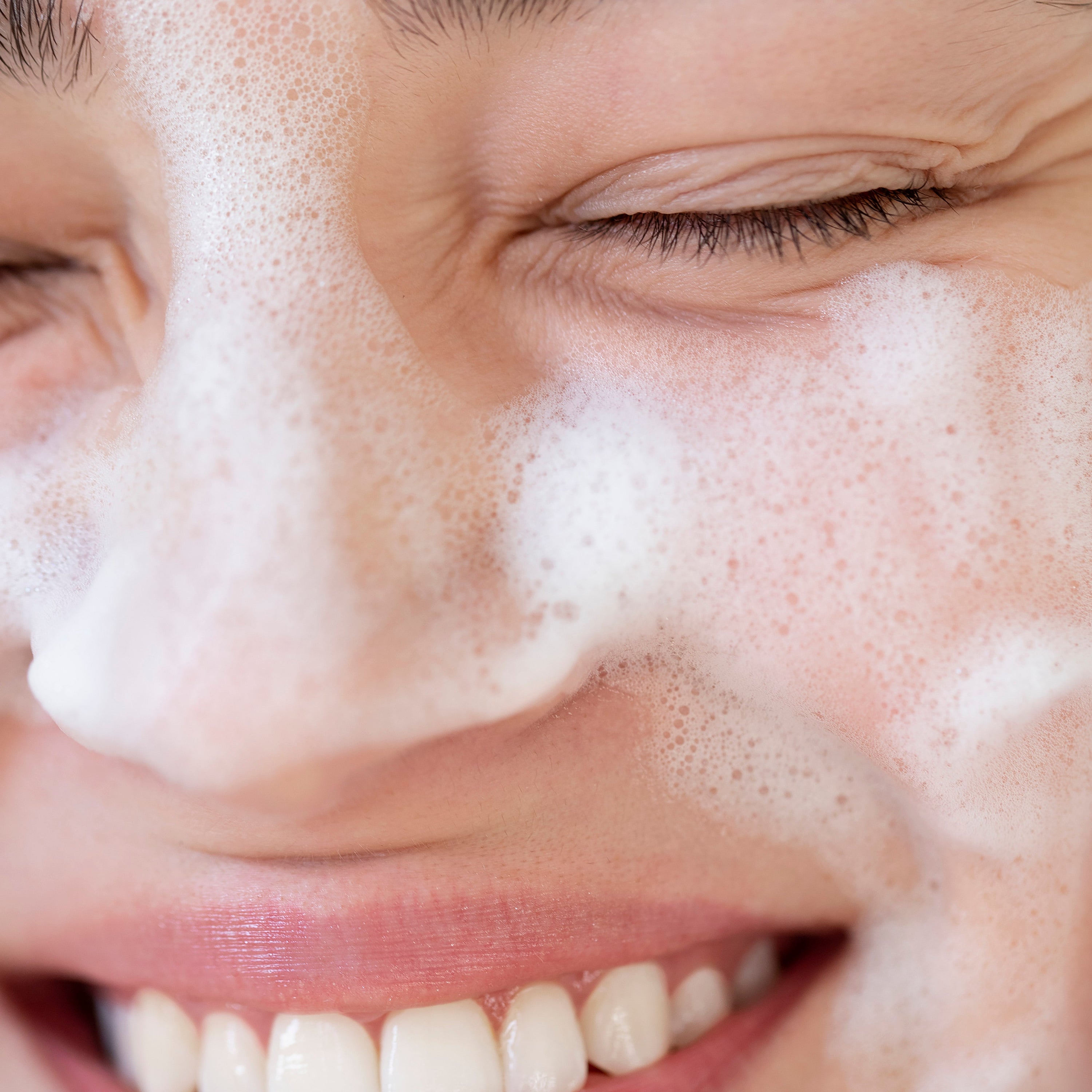 App Rozalı Ciltler İçin Temizleyici Ürün Seçimi Nasıl Olmalı?