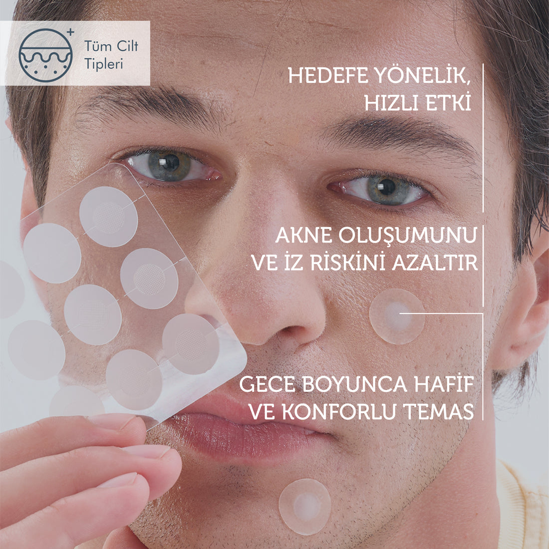 Microneedle Teknolojili Akne Patch, Sivilce Karşıtı Yama, Mikroiğneli Akne Bandı, 9 Adet