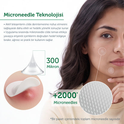 Microneedle Teknolojili Akne Patch, Sivilce Karşıtı Yama, Mikroiğneli Akne Bandı, 9 Adet