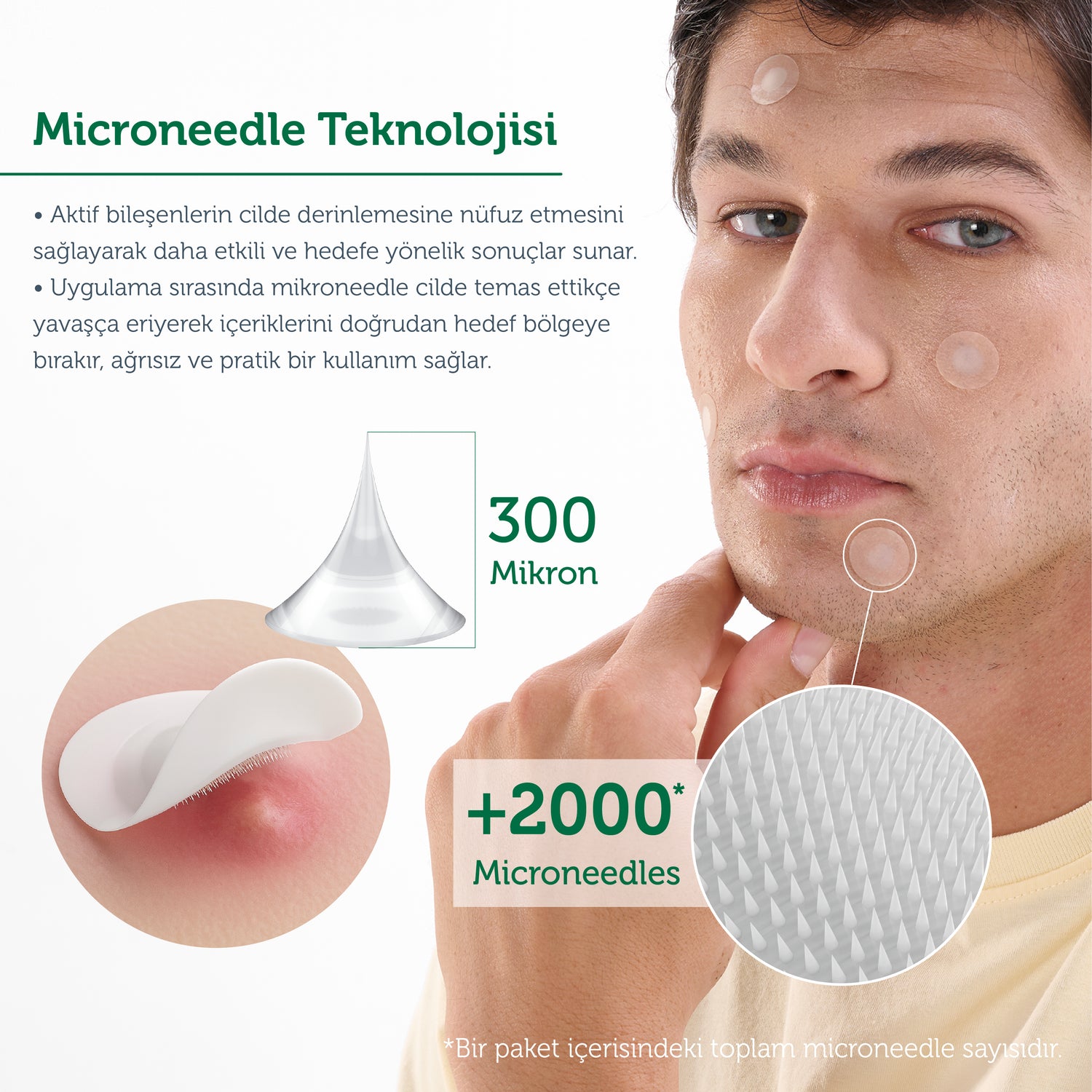 Microneedle Teknolojili Akne Patch, Sivilce Karşıtı Yama, Mikroiğneli Akne Bandı, 9 Adet