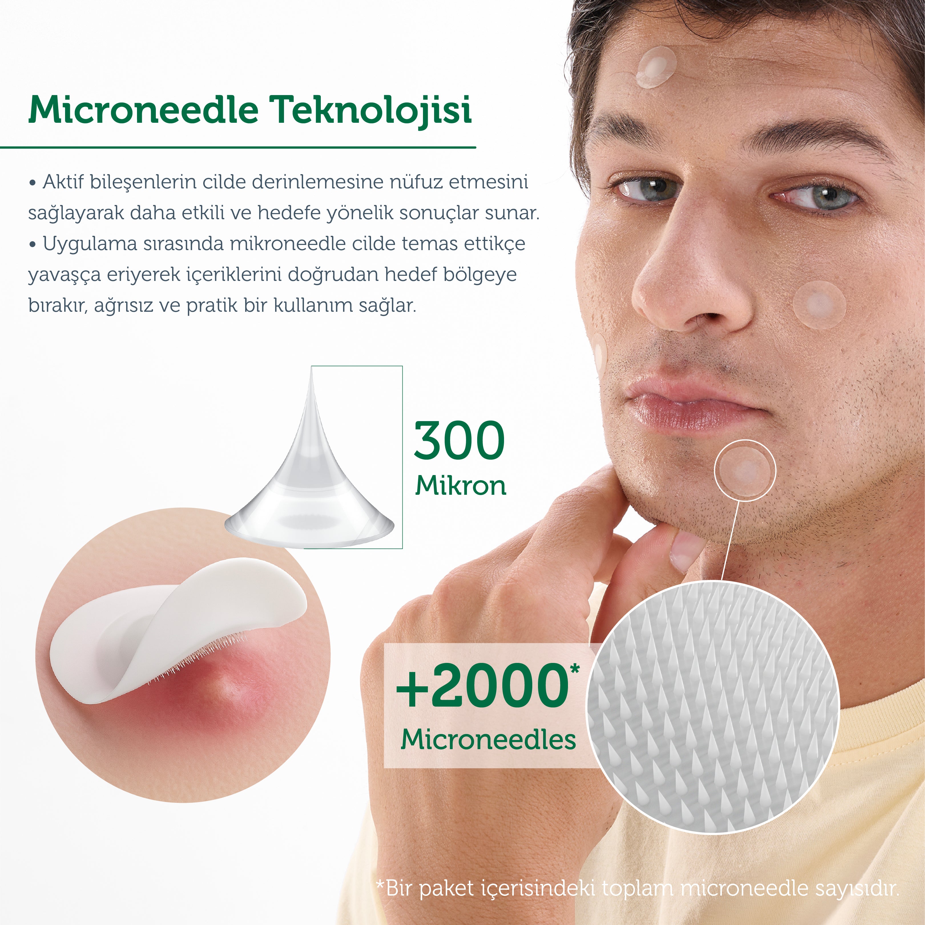 Microneedle Teknolojili Akne Patch, Sivilce Karşıtı Yama, Mikroiğneli Akne Bandı, 9 Adet